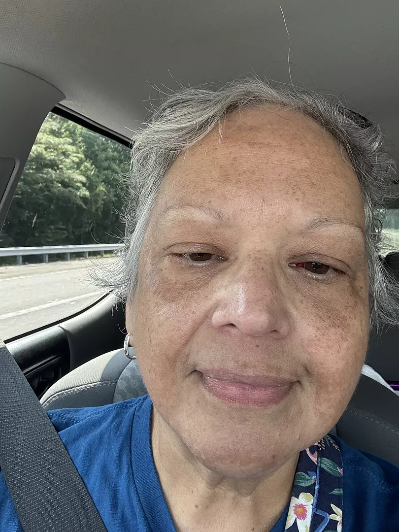 Before - Dark skin tone