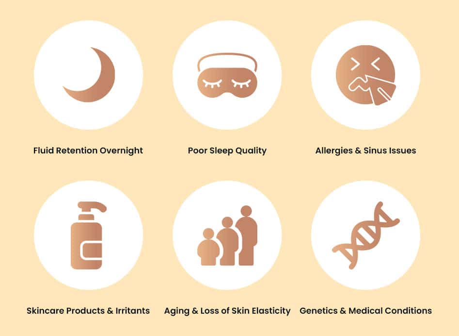 Reasons for puffy eyes every morning