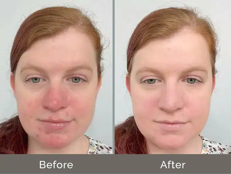 Before and after CC cream