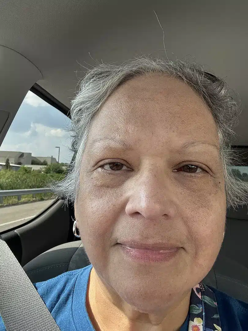 After - Dark skin tone