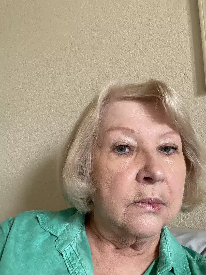 After - Light skin tone